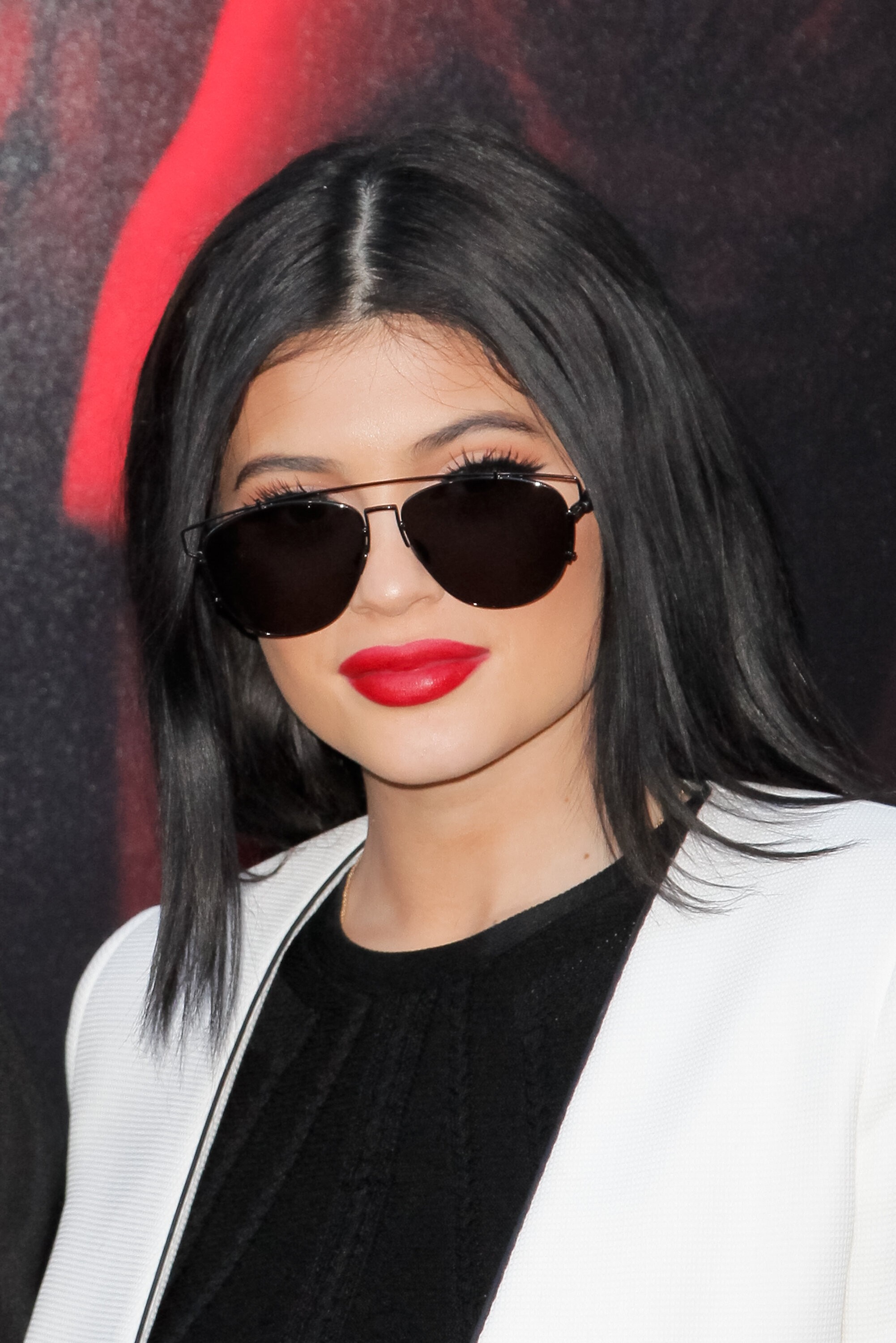 Kylie Jenner has publicly admitted to her use of lip fillers, popularizing the trend.